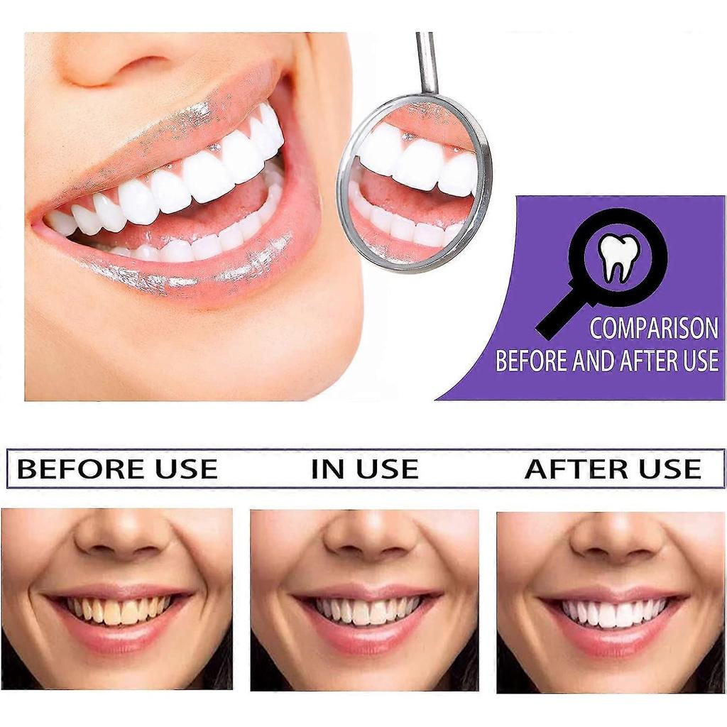 Purple Toothpaste Whitening Toothpaste Teeth Whitening Toothpaste Color Corrector Toothpaste Tooth Whitening Toothpaste Teeth Stain Remover Purple Tee