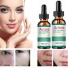 Укрепляющая сыворотка с ретинолом, укрепляющая лифтинг-эссенция, смягчает кожу, повышает эластичность, разглаживает морщины, сыворотка для ухода за кожей лица для женщин
