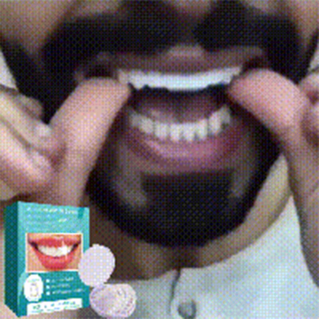 Регулируемые защелкивающиеся зубные протезы, временные пломбировочные зубы, брекеты, пломбирование, исправление зубов, наборы зубных протезов