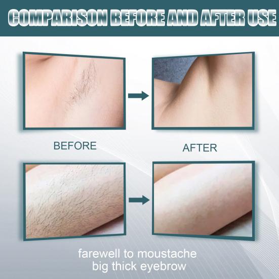 Cream Painless Wide Application Significant Effect Mustache Hair Removal Cream