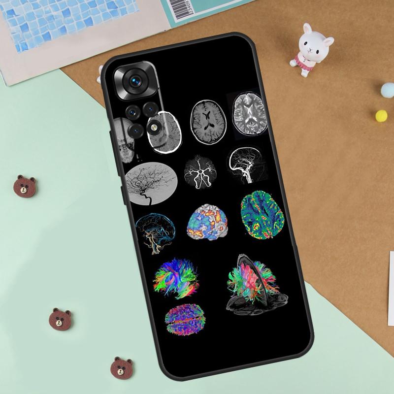 Чехол Anatomy Brain Для Xiaomi Redmi Note 13 12 11 9 10 14 Pro 10S 11S 12S Чехол Для Redmi 13C 10C 12C 14C