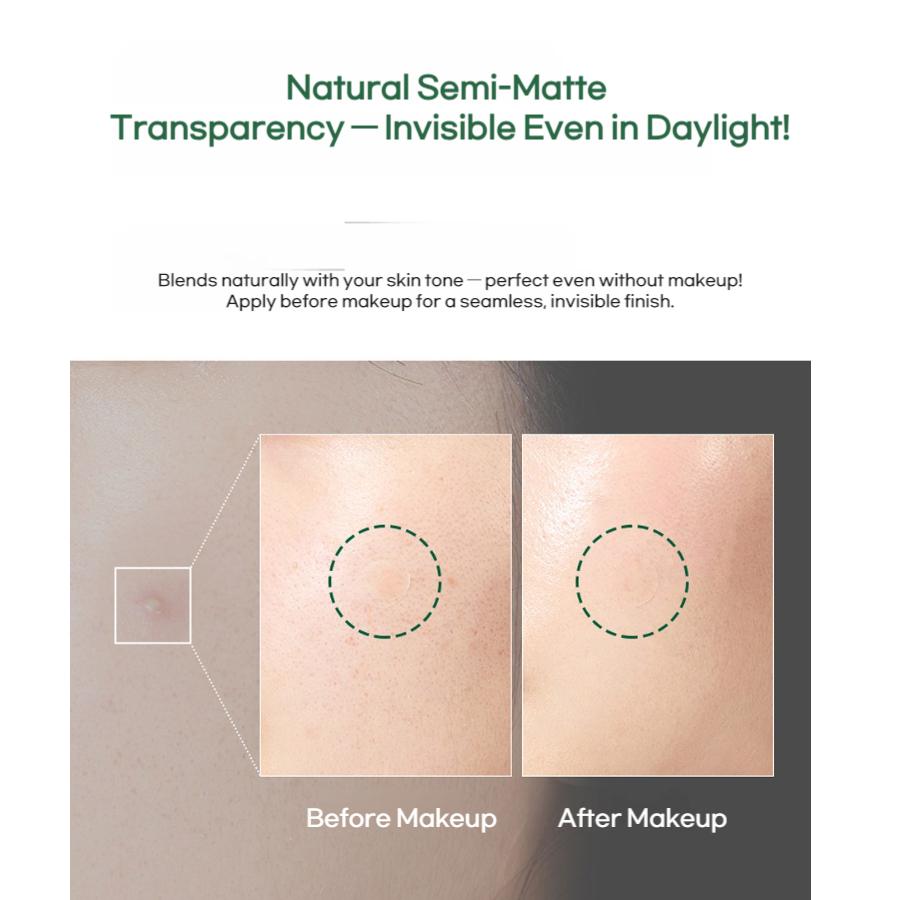 MEDI-PEEL Фито Циканол B5 Точечные патчи S (12 пластырей × 2 упаковки)