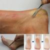 Skin Cutter Remover Shaver Pedicure Kit Pedicure Tool Manicure Kits Foot Care Tools Shaver Feet
