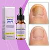 Nail Nutrient Solution; Nail Care,Quickly Remove Discolored Nails; Effectively Soften Thick Nails; Strengthen Nail Bed Structure,1pc,20ml