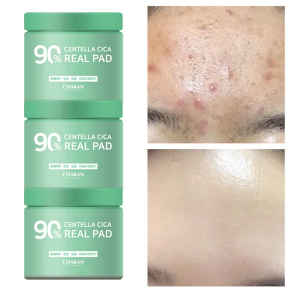 Good Factory Trouble Pore Успокаивающий отшелушивающий себум Centella Sica 90% Real Toner Pad, 1 шт.. Centella Sica 90% Real Toner Pad 1, 3, 70 листов