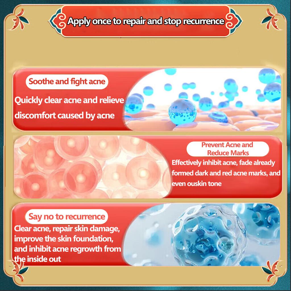 Крем для очищения от акне - Натуральная экстракция+Сужение пор+Удаление черных точек, Ежедневный уход за кожей, склонной к акне, и улучшение пор/черных точек после акне