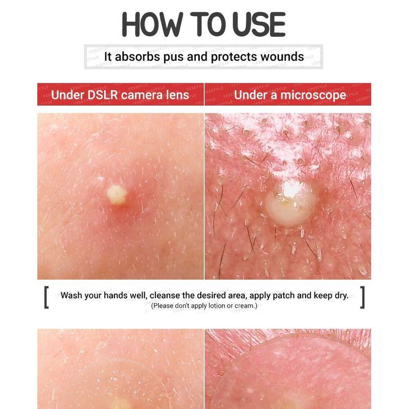 Elizavecca Патчи от прыщей Witch Piggy Hell Pore