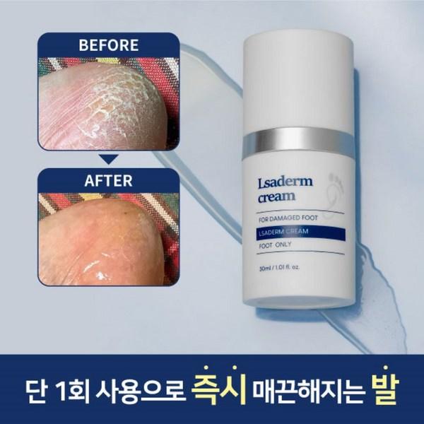 Крем для ног LeSaderm, отшелушивание проблемных пальцев и подошв, противогрибковое средство для ног спортсменов ороговевающего типа, 30г, 1 шт., 1 шт.