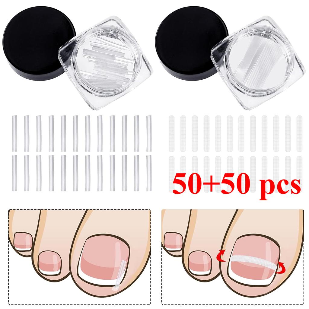 Корректор вросшего ногтя Полоски Ноготь Коррекция Ногтя Корректор Зажим Для Коррекции Выпрямление Ногтя Восстанавливающий Пластырь Корректор Изогнутого Ногтя 2 Стили