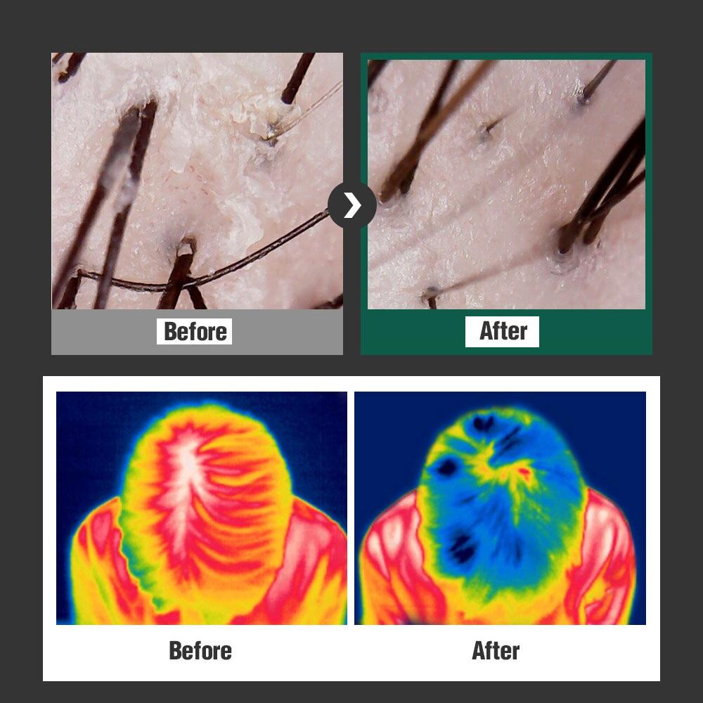 DASHU Ежедневный травяной тоник против выпадения волос 150 мл