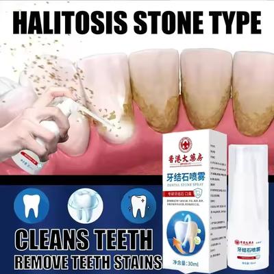 Средство для удаления зубного камня, отбеливающий спрей для зубов, чистка зубов, гигиена полости рта, удаление неприятного запаха изо рта, налет, пятна, свежее дыхание