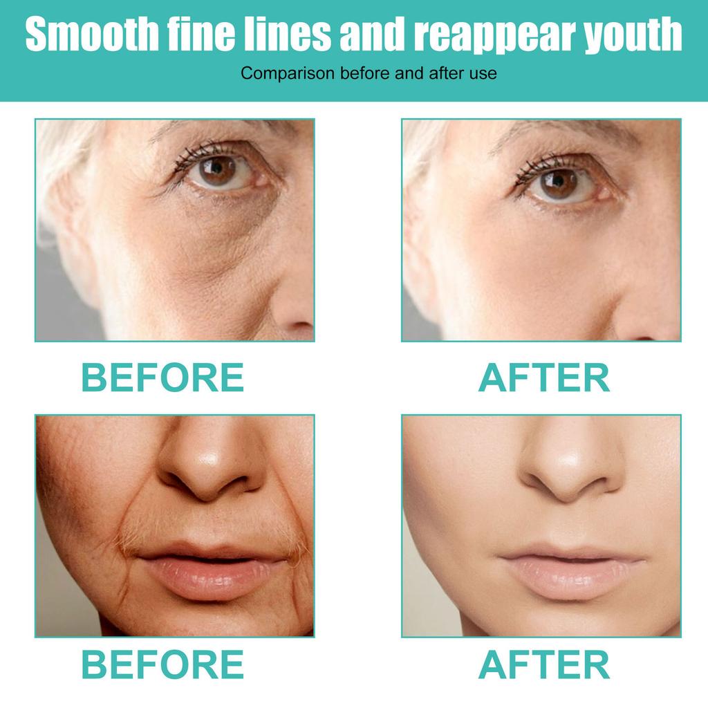 EELHOE Сыворотка для лица с гиалуроновой кислотой, увлажняющая, отбеливающая, укрепляющая, выцветает, тонкие линии, против морщин, против старения, эссенция для глубокого ухода, 30 мл