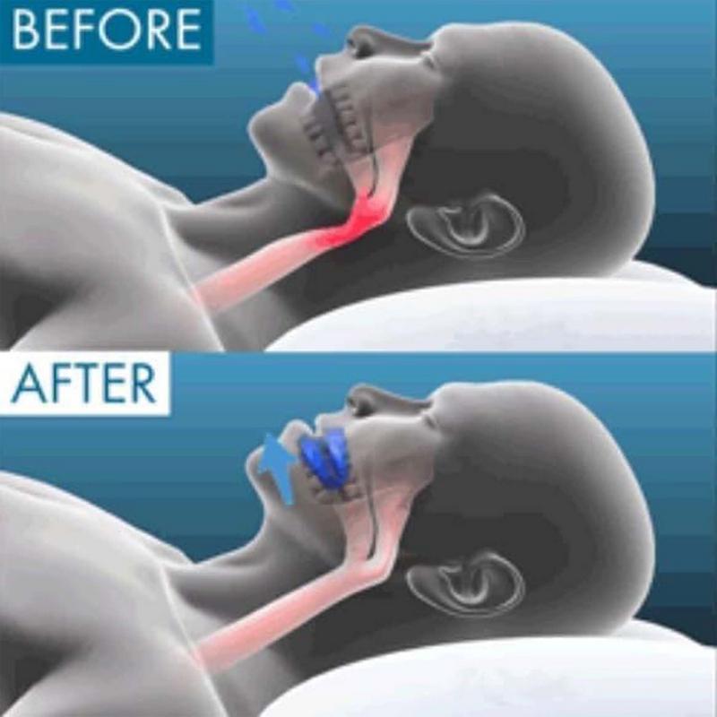 Anti Snoring Kit Grinding Mouthpiece Anti Snore Mouith Guard Custom Molding & Adjustable Adjustment with Storage Case