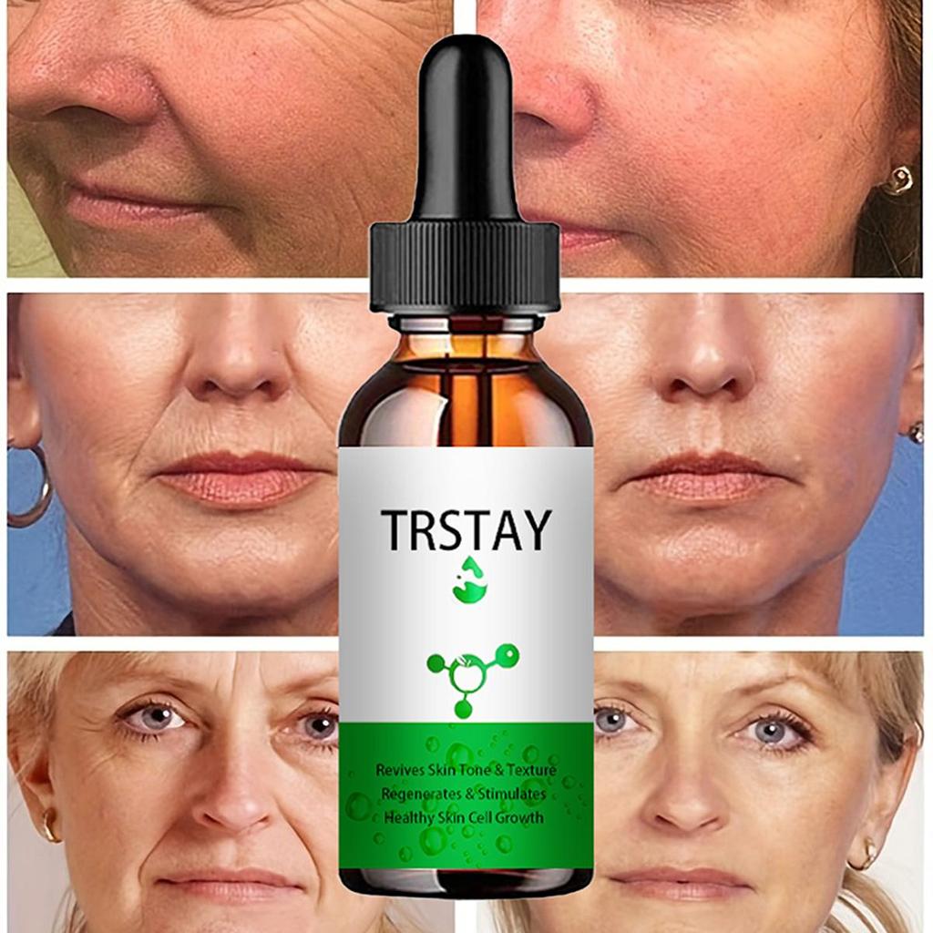 5ML/15ML/30ML/50ML/Anti Redness Solution ,Spider Vein Removal Advanced Treatment Clearer Skin Veins On Face