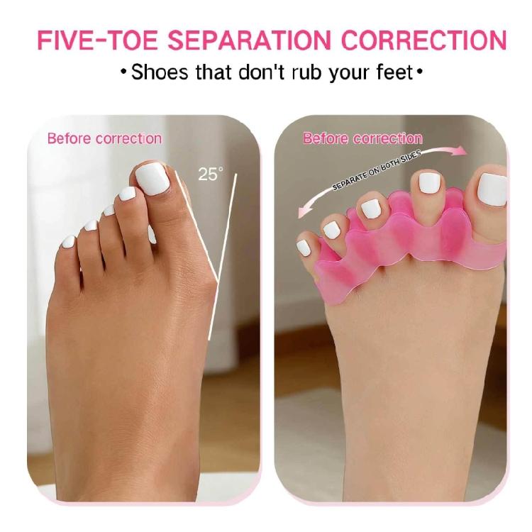 Breathable Silicone Toe Straighteners 5-hole Toe Separators For Women And Men With Soft Texture And Ergonomic