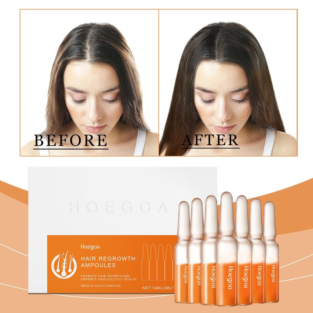 Ампулы для роста волос Восстановление против выпадения волос Восстановление секущихся кончиков Сухие поврежденные волосы Эфирное масло Питание кожи головы Портативный уход за волосами