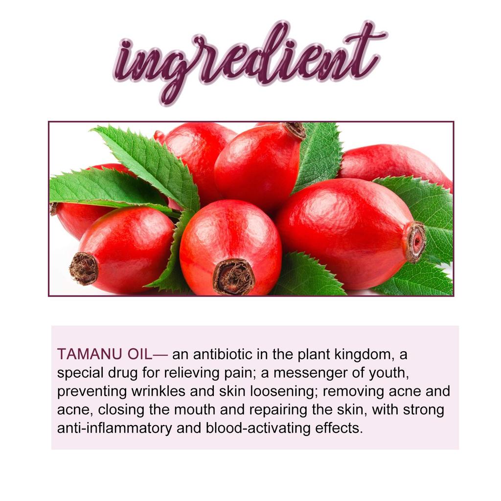 EELHOE Масло для лица «Бегония» уменьшает следы от прыщей, осветляет морщины, увлажняет и укрепляет кожу. Эфирное масло