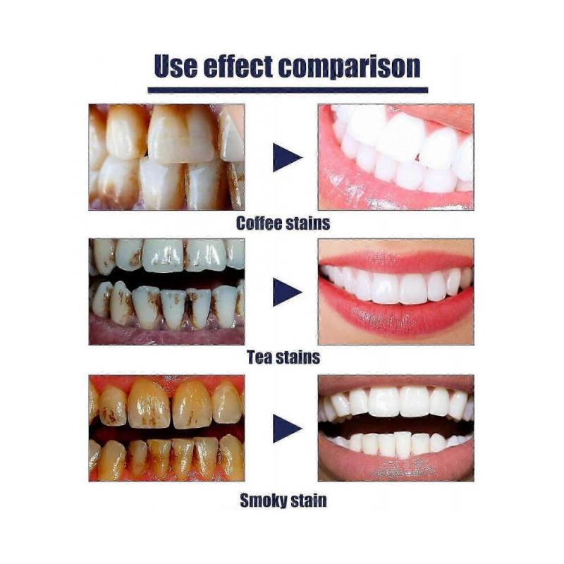 Whitening Toothpaste, Teeth Whitening Paste, Sparkly White Herbal Toothpaste for Smokers, Fresh Breath, Remove Yellow Tooth Stains, Deep Cleaning less