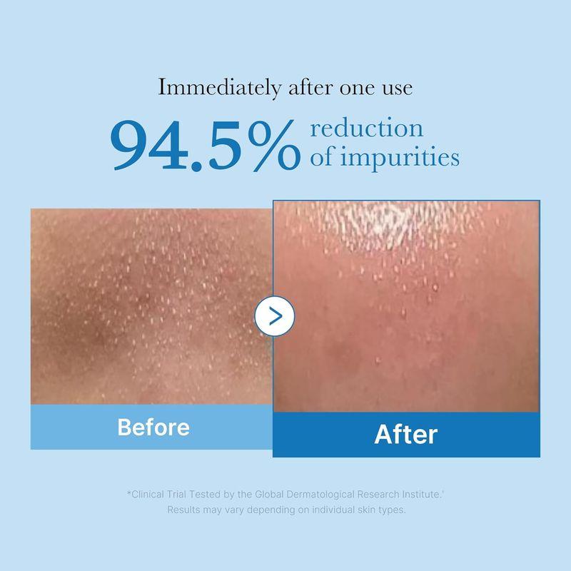 Medicube Глубоко очищающее масло Zero Pore Blackhead 205 мл