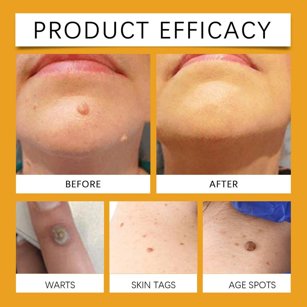 Bee, 30 мл Tag Recede Bee Spray, Пчелиный спрей Tagrecede для кожи. Безопасен для всех типов кожи.