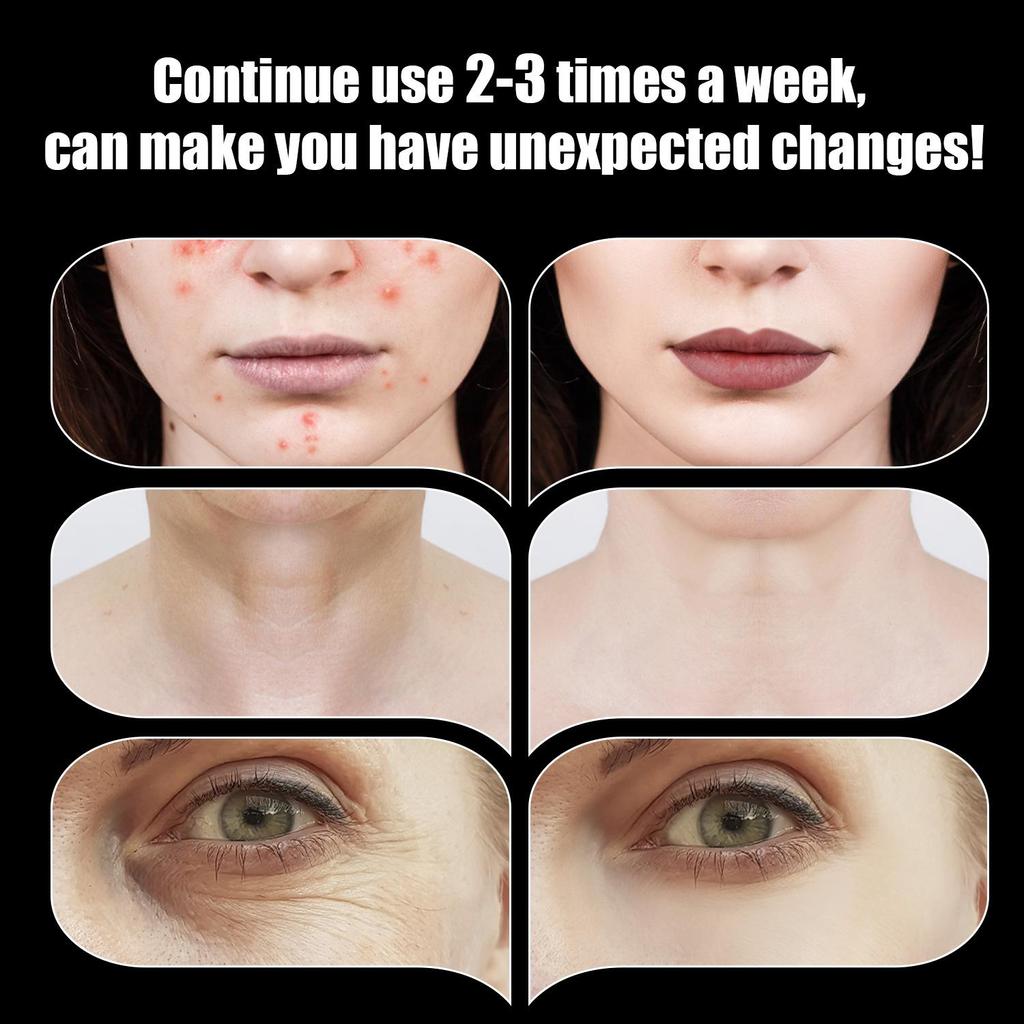 Портативная высокочастотная машина для ухода за лицом, удаление морщин, акне, палочка для ухода за лицом с 6 неоновыми и аргоновыми палочками