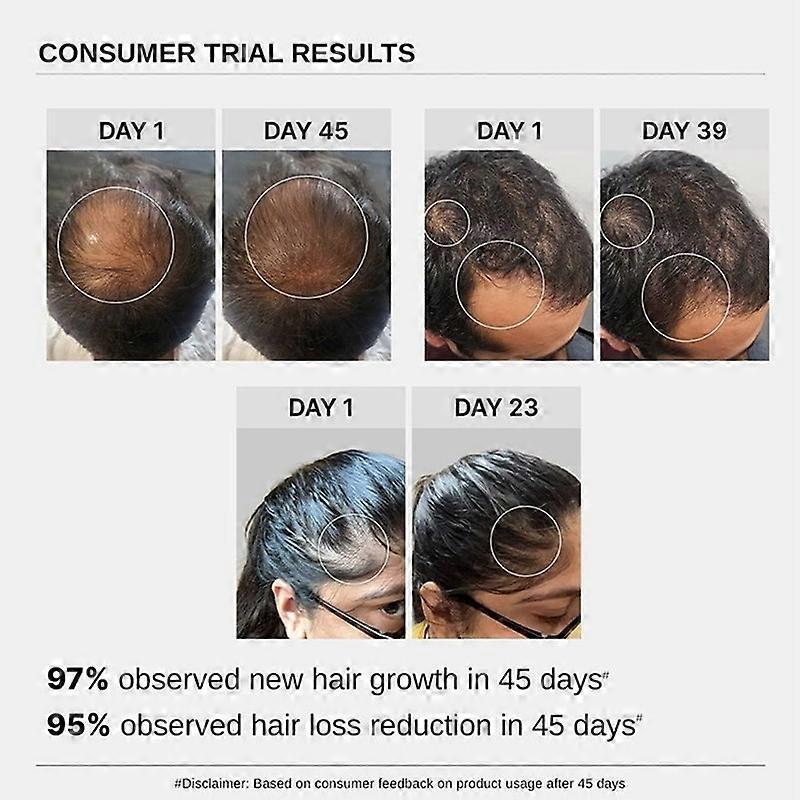 1/2/3/4/5x Bare Anatomy Advanced Hair Growth Serum - 30ml