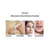 Derma Wand Anti-Aging Face RF Beauty Instrument - Massage Device with EU Plug for Skin Rejuvenation & Wrinkle Reduction