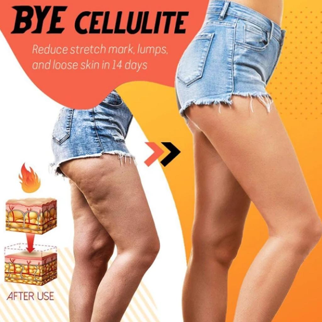 Loss Spray Burning Loss Slimming Spray, Lose Weight Cellulite 10ml