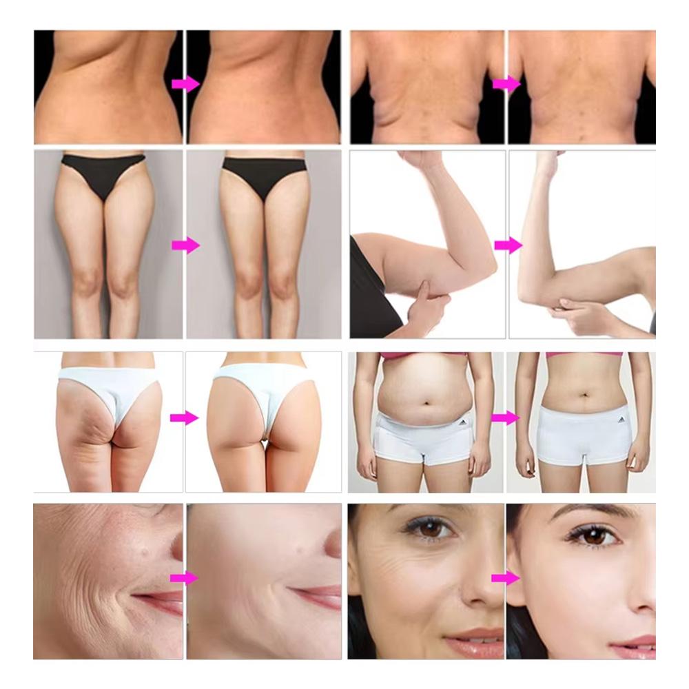 5 В 1 40k/80k Аппарат для ультразвуковой кавитации RF Вакуумная система для коррекции фигуры Профессиональное оборудование для салона красоты