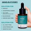 Dr. Sakhiya's 2% Salicylic Acid Anti Acne Pimple Serum For Glowing Skin 30ml