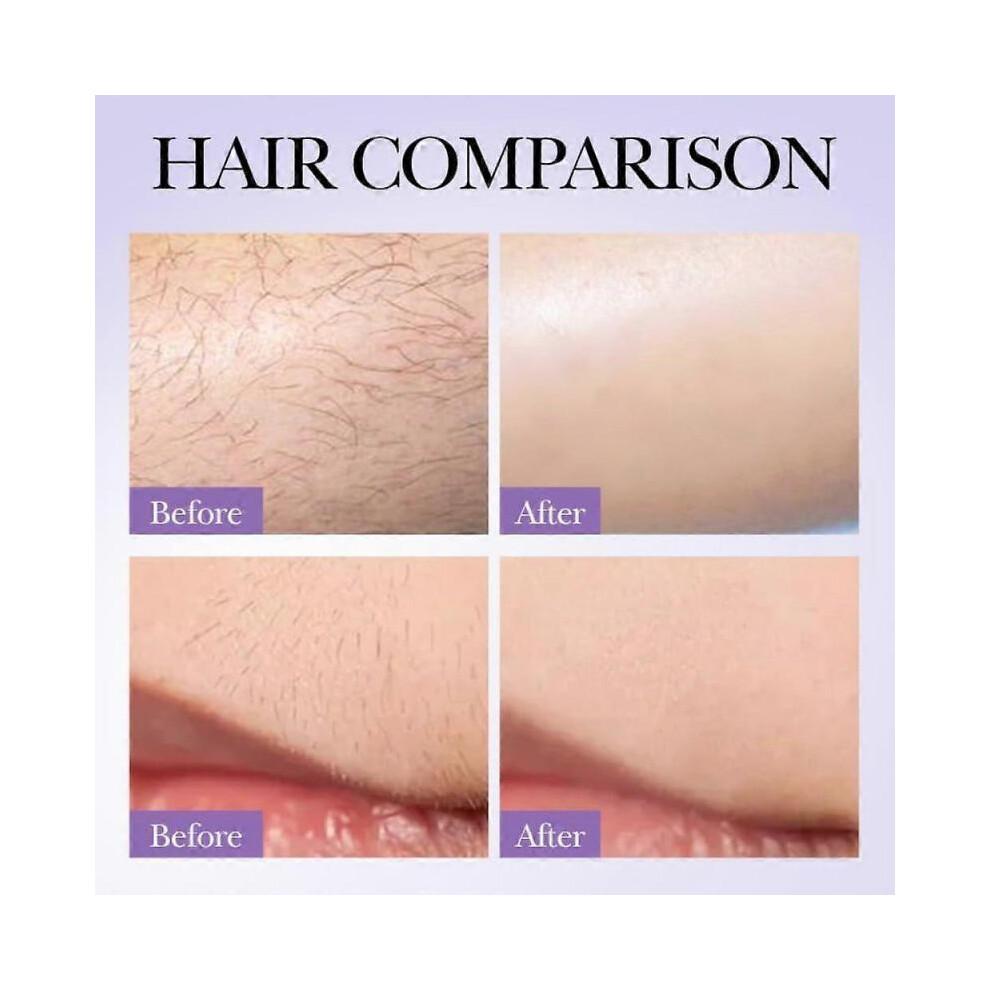 Hair Removal Cream+Hair Growth Inhibitor Spray + Strawberry Vanilla After Shave Oil women for Smooth Skin, Painless and Gentle Hair Removal Soothing &