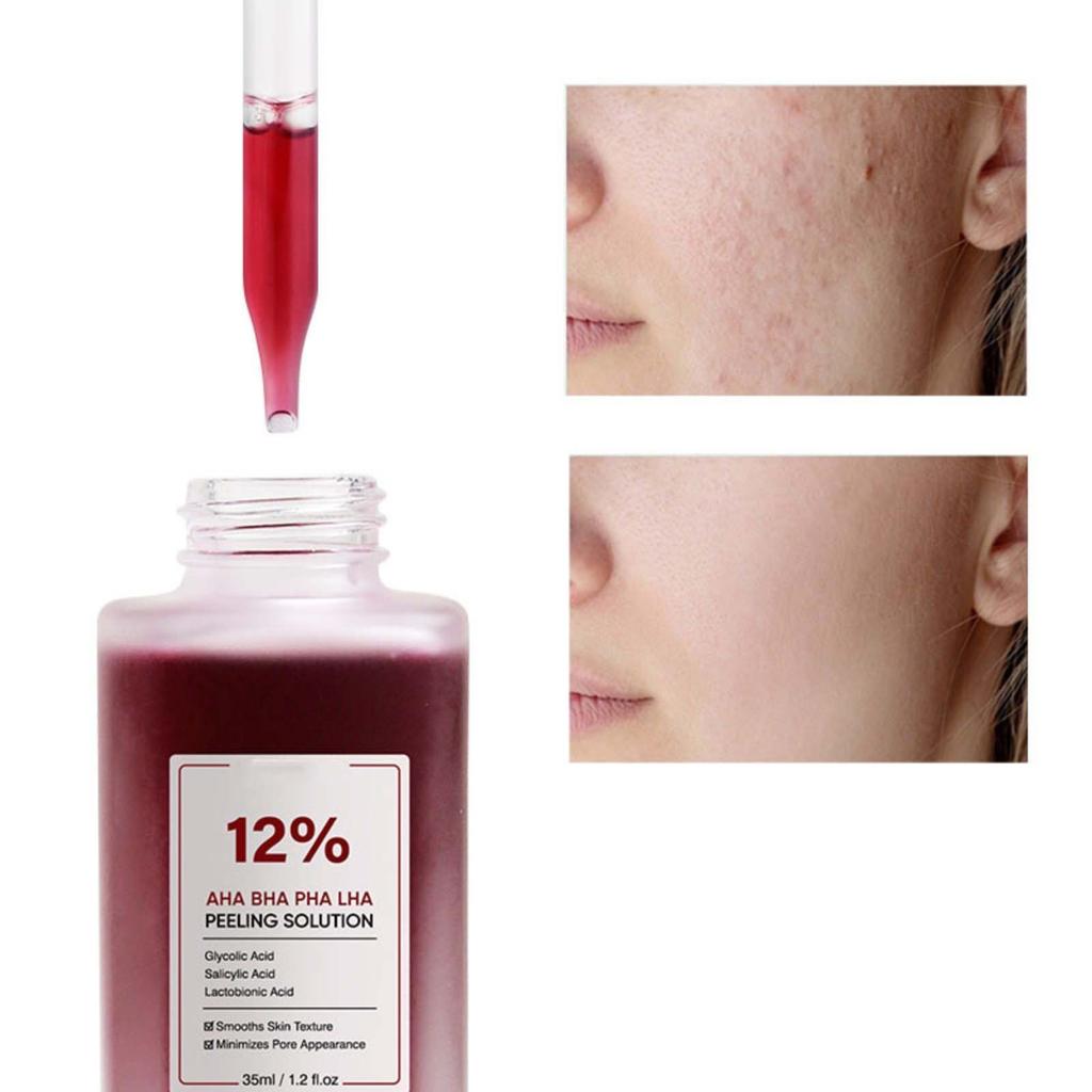 Фруктовый салициловый пилинг от черных точек, угрей, шрамов, акне, сужение пор, увлажнение 35 мл