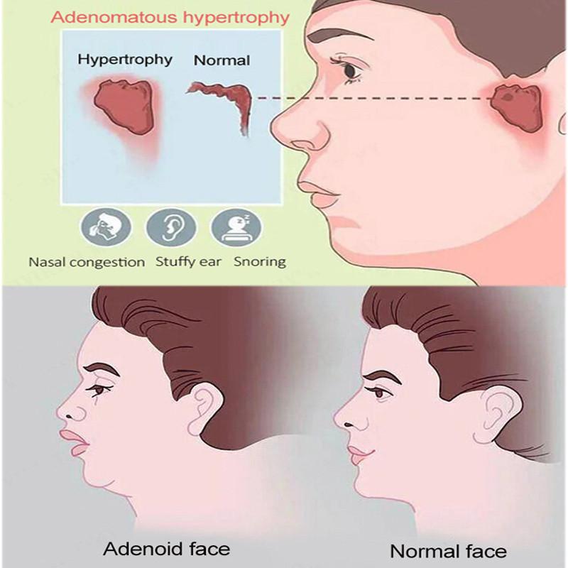 Маска для похудения лица, морщины, подтяжка лица, уменьшение двойного подбородка, тонкий пояс, бандаж для похудения, уход за кожей
