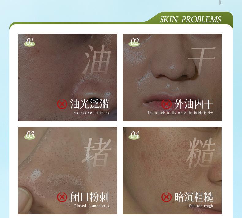 OPPEIN Men's Moisturizing and Oil Control Set
