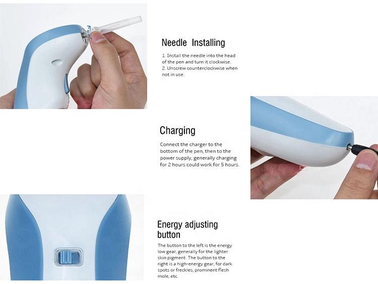 Перезаряжаемая Волшебная Ручка для удаления веснушек и родинок - Плазменный Косметологический Аппарат с Магнитной Левитацией