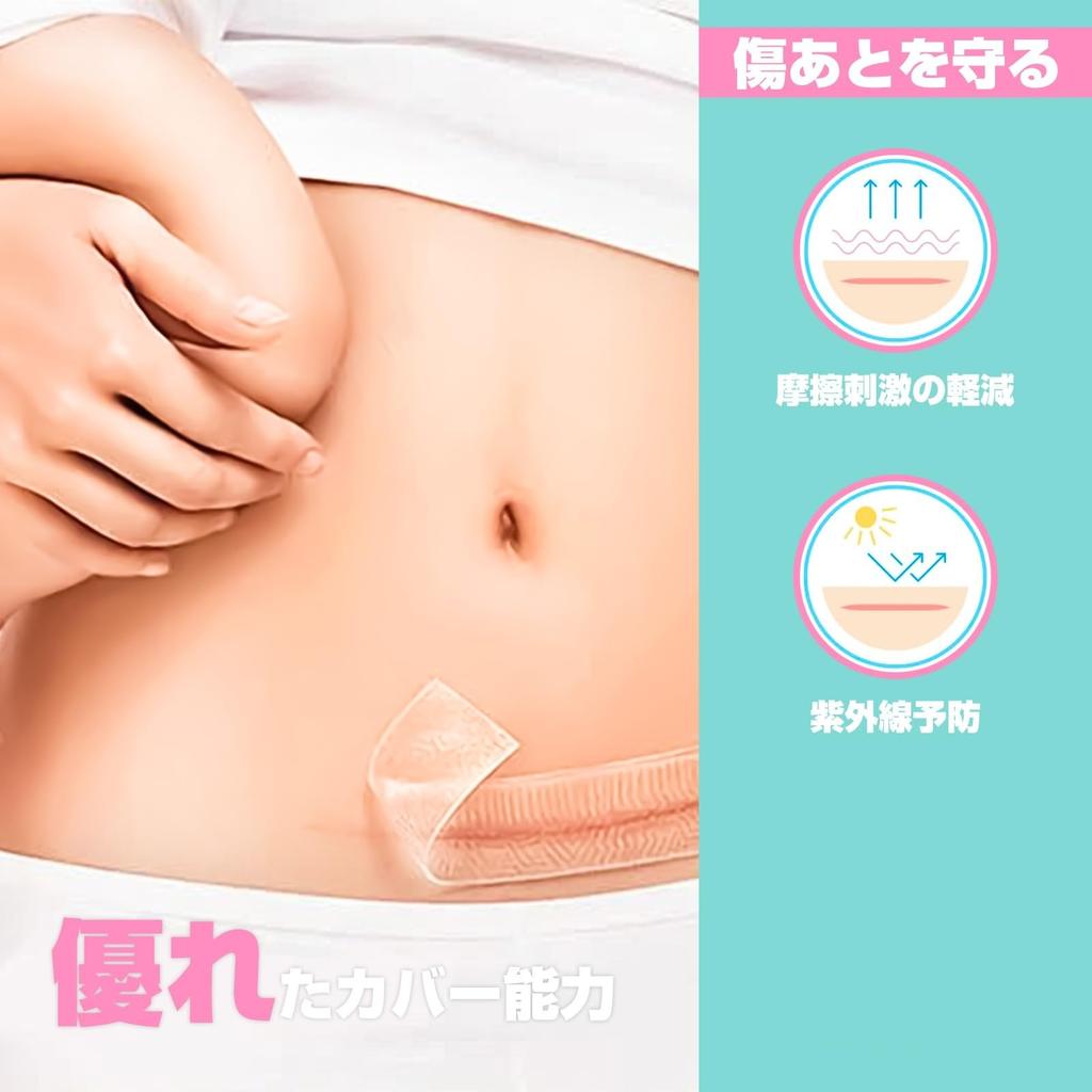 CMD Scar Care Tape, Keloid Tape, 4cm x 150cm, Cesarean Section Scar Care, Scar Concealment, Silicone Gel Sheet, Skin Color (1 Roll)