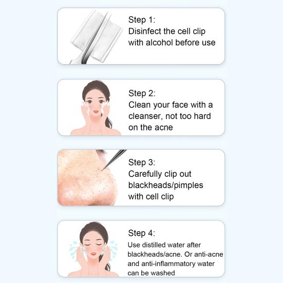 Yousheng 7 шт. набор инструментов для удаления черных точек из нержавеющей стали набор для удаления угрей профессиональный инструмент для удаления черных точек и белых угрей для лица