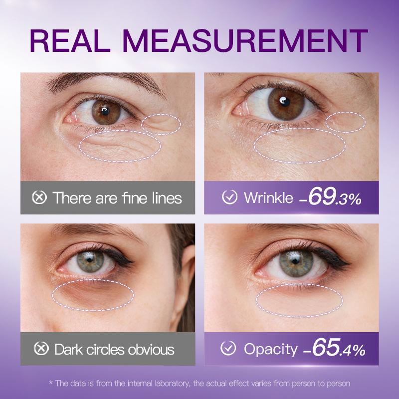 Коллагеновый патч для глаз от мешков под глазами, мгновенное исчезновение мелких морщин, темных кругов, жировых частиц, против отечности, пептид змеиного яда, замороженная маска для глаз