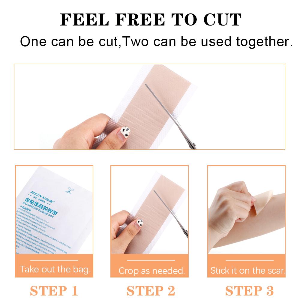 4x150 см силиконовая повязка от шрамов, эффективная хирургическая гель-лист для удаления, терапевтический пластырь, пластырь от прыщей, травм, ожогов, восстановление кожи, лечение шрамов
