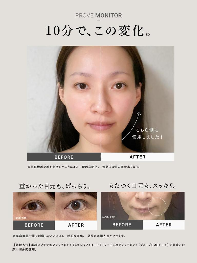 От medical мой лучший MYTREX PROVE Устройство для красоты лица Электрическая щетка Популярный Total Lift EMS для области вокруг глаз Водонепроницаемый Подарок Подарок Докажите [Рекомендуемые группы]