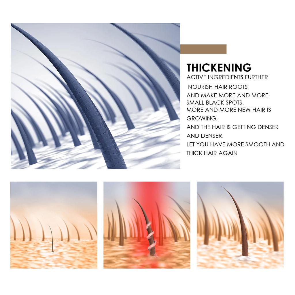 EELHOE Шампунь с рисовой водой, натуральное мыло, очищающее кожу головы, питательный уход за волосами, мыло ручной работы для роста волос