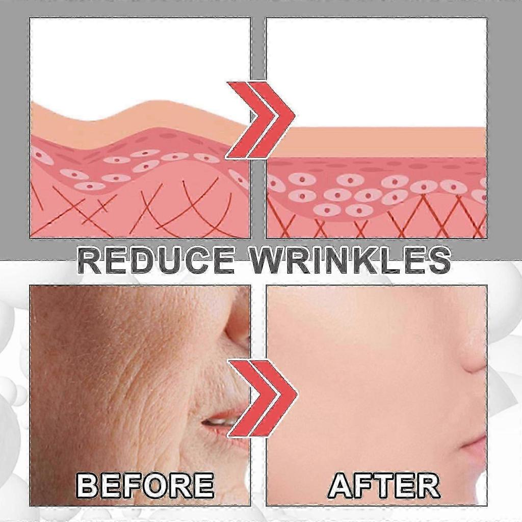 3PCS Collagen Boost Anti-Aging Serum,Blemish Skin Corrector Serum for Face With Hyaluronic Acid, Collagen Boost Anti-Aging Anti Wrinkle Serum 30ML