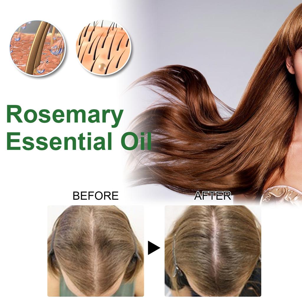 EELHOE Эфирное масло розмарина для ухода за волосами, против роста волос, гладкая сыворотка, масло для волос, против выпадения волос, новые средства для красоты волос