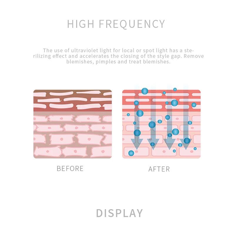 Новая технология омоложения кожи, импорт и экспорт, токовая терапия средней частоты, высокочастотный косметический аппарат
