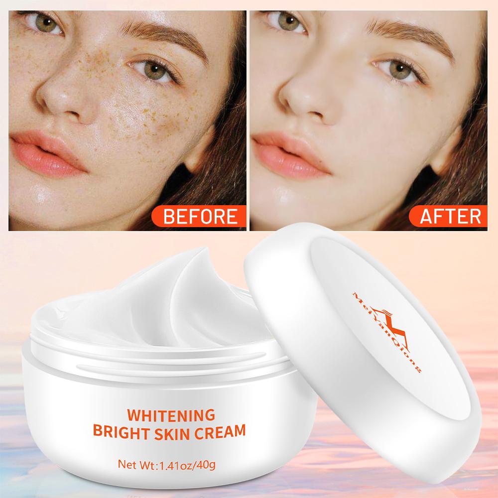Отбеливающий крем от веснушек с увлажняющим эффектом 40 г для лица Beauty Qiong