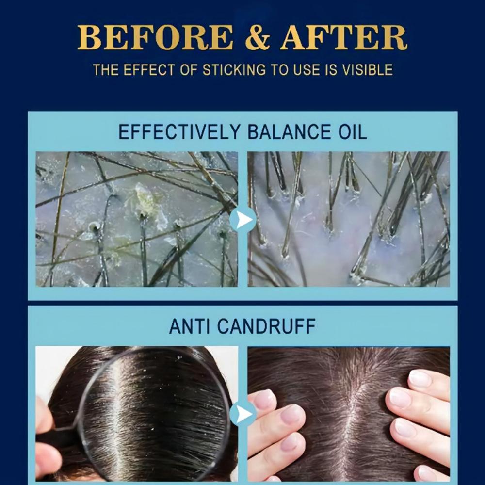 Hair Care Essence Spray Strong Hair Anti Drop Moisturizing Nourishing Liquid