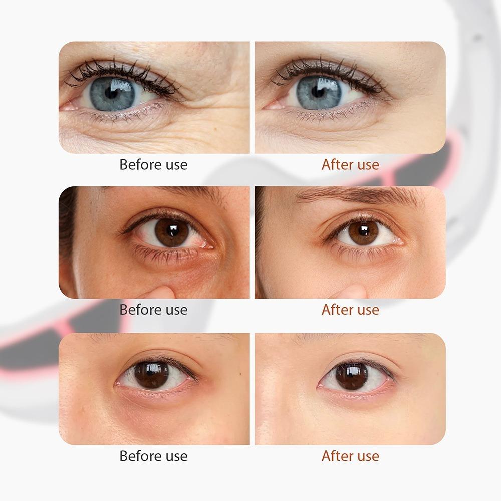 Electric Massager Eye Care Machine Micro-Current EMS Eye Relax Eye Massager  Skin Care