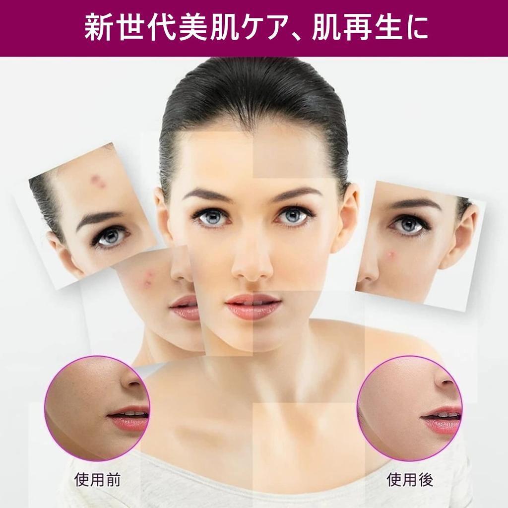 SrDiot Derma Roller Микроигольчатый ролик Красивый ролик для лица Ролик для лица Красивая кожа Пятна на коже головы Истончение волос Уход за порами Уход за лицом Уход за кожей