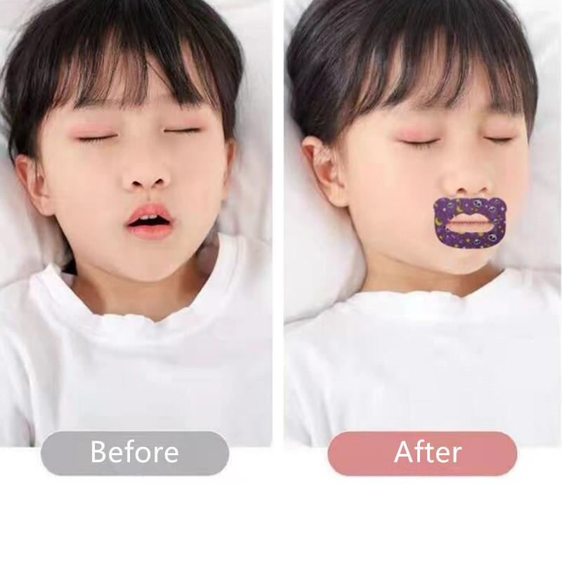 30 шт./кор., наклейки против храпа для детей, детский ночной сон, пластырь для улучшения дыхания, губ, носа, коррекция рта, ортезирующая лента