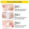 DermaAngel - Пластырь от акне с салициловой кислотой для дневного использования, 24 шт.